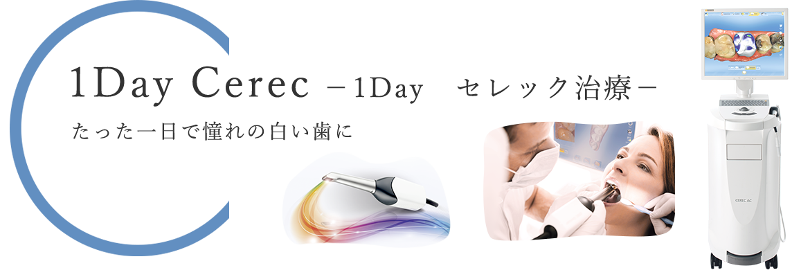 図：１Day Cerec　1Dayセレック治療　たった一日で憧れの白い歯に